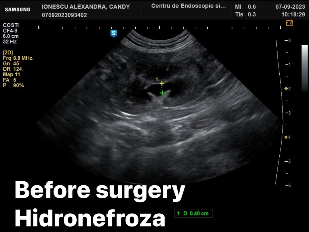 Centru de endoscopie și chirurgie minim invazivă veterinară