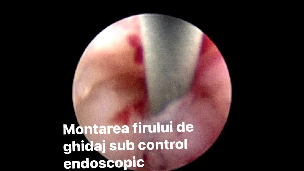 Centru de endoscopie și chirurgie minim invazivă veterinară